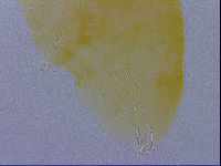 Minibiotus aculeatus image