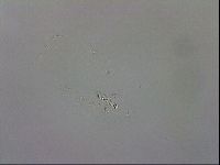 Minibiotus aculeatus image
