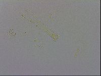 Minibiotus aculeatus image