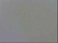 Minibiotus aculeatus image