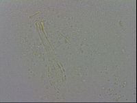 Minibiotus aculeatus image
