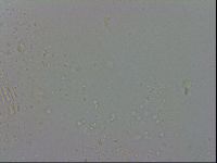 Minibiotus aculeatus image