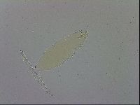 Minibiotus aculeatus image