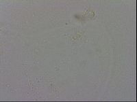 Minibiotus aculeatus image