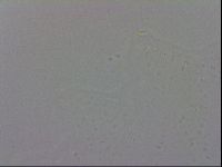 Minibiotus aculeatus image