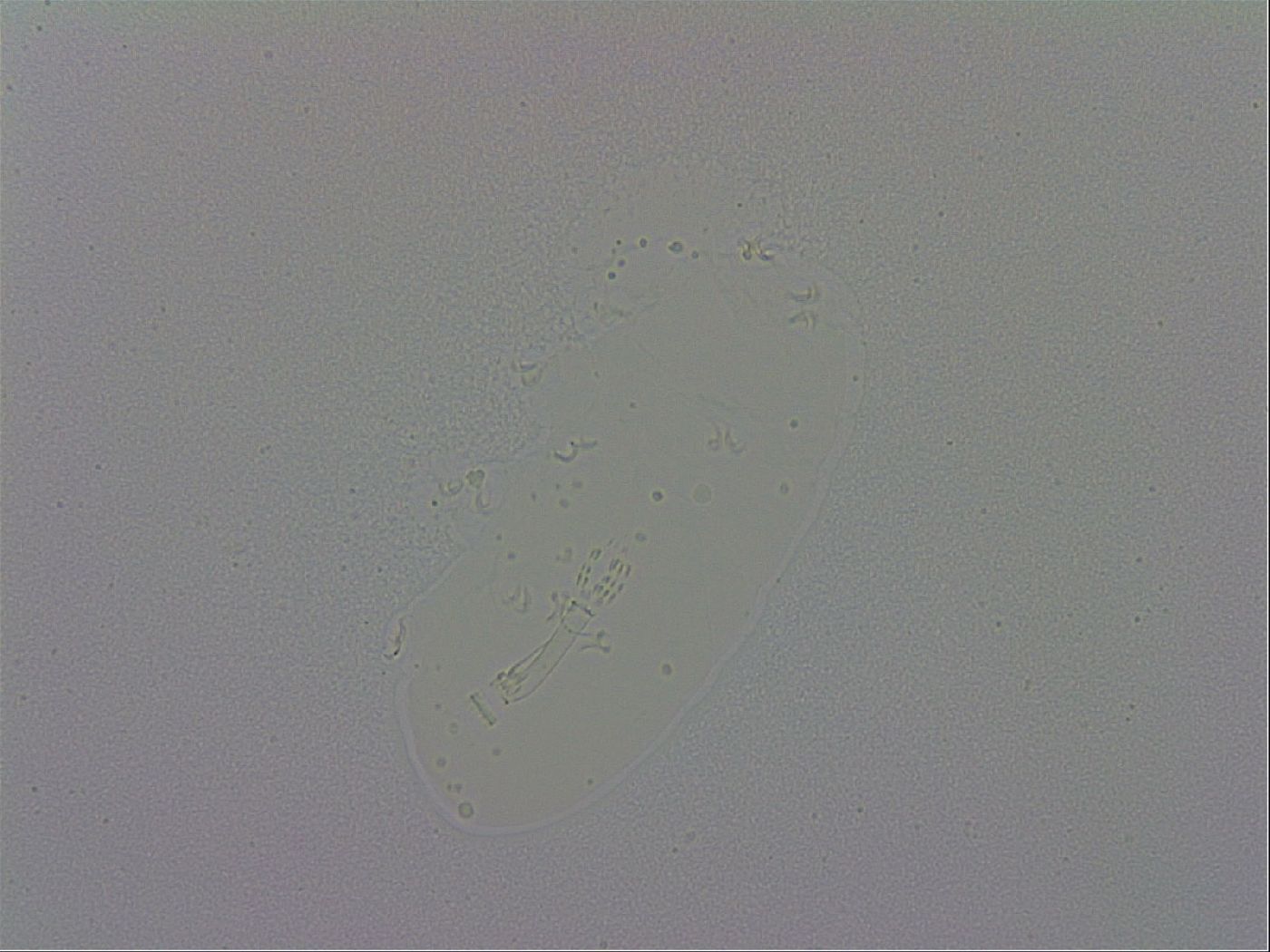 Minibiotus aculeatus image