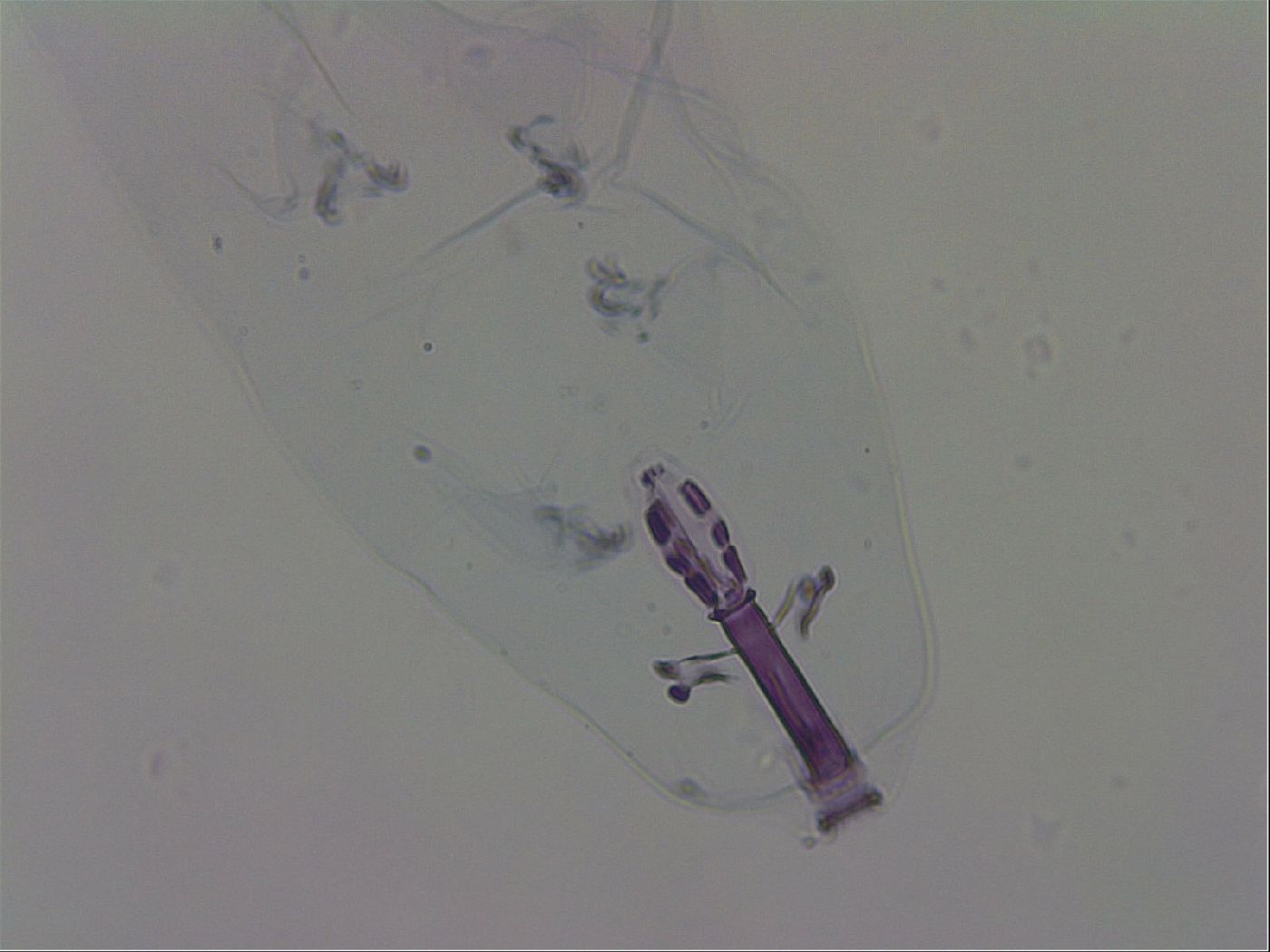 Minibiotus aculeatus image