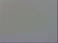 Minibiotus aculeatus image