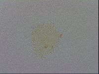 Media resource of Paramacrobiotus areolatus