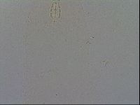 Paramacrobiotus areolatus image