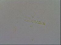 Paramacrobiotus areolatus image