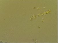 Paramacrobiotus areolatus image