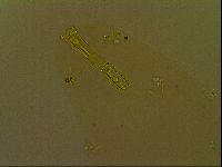 Paramacrobiotus areolatus image