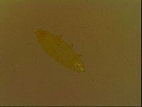 Paramacrobiotus areolatus image