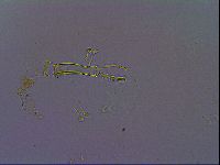Paramacrobiotus areolatus image