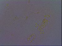 Paramacrobiotus areolatus image