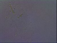 Paramacrobiotus areolatus image