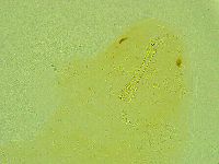 Paramacrobiotus areolatus image