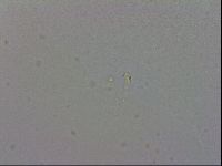 Mesobiotus furciger image