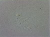Mesobiotus furciger image