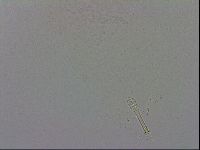 Mesobiotus furciger image