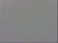 Mesobiotus furciger image