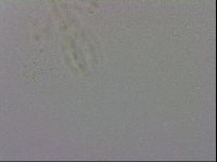 Mesobiotus furciger image