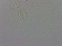 Mesobiotus furciger image
