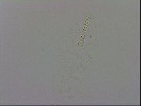 Mesobiotus furciger image