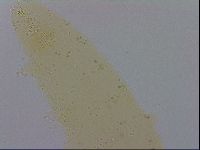 Mesobiotus furciger image