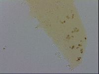 Mesobiotus furciger image