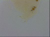 Mesobiotus furciger image