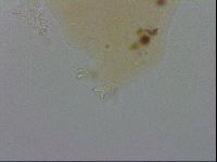 Mesobiotus furciger image