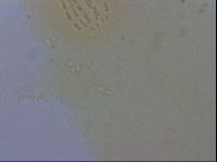 Mesobiotus furciger image