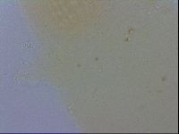 Mesobiotus furciger image