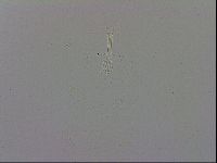Mesobiotus furciger image