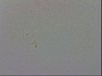Mesobiotus furciger image