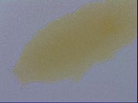 Mesobiotus furciger image