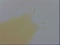 Mesobiotus furciger image