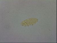 Mesobiotus furciger image
