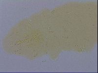 Mesobiotus furciger image