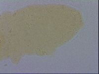 Mesobiotus furciger image