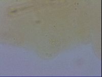 Mesobiotus furciger image