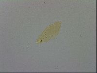 Mesobiotus furciger image