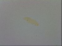 Mesobiotus furciger image