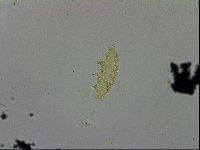 Mesobiotus furciger image