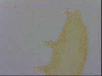 Mesobiotus furciger image