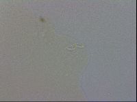 Media resource of Macrobiotus echinogenitus