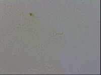 Macrobiotus echinogenitus image