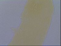 Macrobiotus echinogenitus image